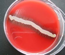 Wakil Haemophilus influenzae