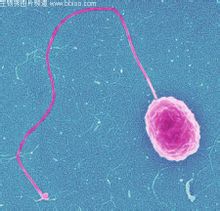 Vibrio parahaemolyticus