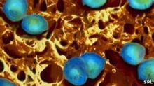 Neisseria gonorrhoeae