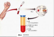 Protein plasma