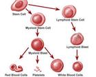 Leukemia kronis myelomonocytic
