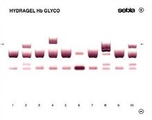 Hemoglobin terglikasi